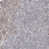 Anti-DIP2C antibody produced in rabbit Prestige Antibodies® Powered by Atlas Antibodies, affinity isolated antibody, buffered aqueous glycerol solution