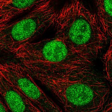 Anti-RNF220 antibody produced in rabbit Prestige Antibodies&#174; Powered by Atlas Antibodies, affinity isolated antibody