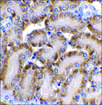 Anti-CAD antibody produced in rabbit affinity isolated antibody