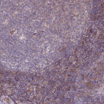 Anti-LRRC41 antibody produced in rabbit Prestige Antibodies&#174; Powered by Atlas Antibodies, affinity isolated antibody, buffered aqueous glycerol solution