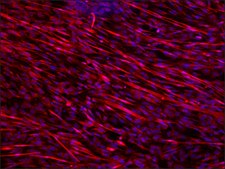 Anti-Dysferlin antibody produced in rabbit ~1.0 mg/mL, affinity isolated antibody