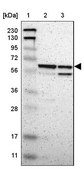 Anti-ARHGAP1 antibody produced in rabbit Ab2, Prestige Antibodies® Powered by Atlas Antibodies, affinity isolated antibody, buffered aqueous glycerol solution