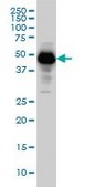 Monoclonal Anti-SERPINI1 antibody produced in mouse clone 1D10, purified immunoglobulin, buffered aqueous solution