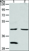 Anti-NCEH1 antibody produced in rabbit affinity isolated antibody