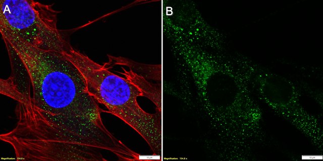 Anti-AGTR1 Antibody, clone 1I12 ZooMAb&#174; Rabbit Monoclonal recombinant, expressed in HEK 293 cells