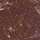 Anti-PPP1R18 antibody produced in rabbit Prestige Antibodies® Powered by Atlas Antibodies, affinity isolated antibody, buffered aqueous glycerol solution