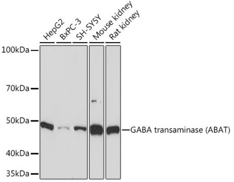 Anti-GABA transaminase (ABAT) Antibody, clone 10V1K9, Rabbit Monoclonal