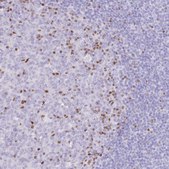 Anti-TOX2 antibody produced in rabbit Prestige Antibodies® Powered by Atlas Antibodies, affinity isolated antibody, buffered aqueous glycerol solution