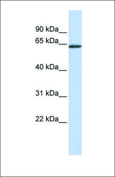 Anti-ANTXR1 antibody produced in rabbit affinity isolated antibody