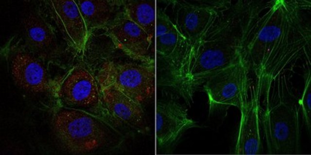 Anti-phospho-VE-Cadherin (Tyr685) Antibody, Alexa Fluor&#8482; 555 Conjugate from rabbit, ALEXA FLUOR&#8482; 555