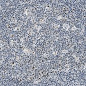 Anti-DDX47 antibody produced in rabbit Prestige Antibodies® Powered by Atlas Antibodies, affinity isolated antibody, buffered aqueous glycerol solution