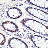 Anti-CDX2 antibody produced in rabbit