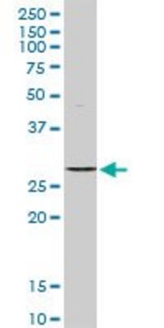 Anti-STK16 antibody produced in rabbit purified immunoglobulin, buffered aqueous solution