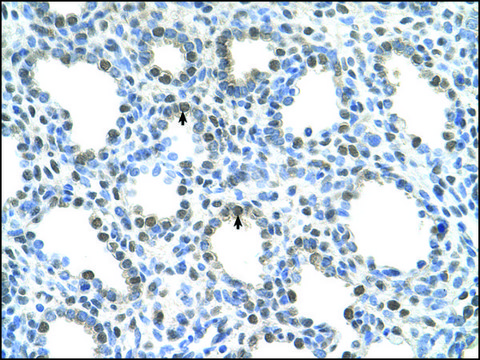 Anti-SLC15A4 antibody produced in rabbit affinity isolated antibody