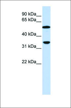 抗-C4B 兔抗 affinity isolated antibody