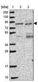 Anti-ITPKC antibody produced in rabbit Prestige Antibodies® Powered by Atlas Antibodies, affinity isolated antibody, buffered aqueous glycerol solution