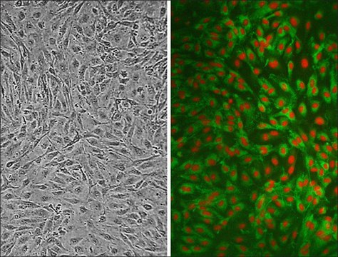 Human Carotid Artery Endothelial Cells: HCtAEC, adult