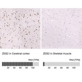 Monoclonal Anti-Zeb2 Antibody Produced In Mouse Prestige Antibodies® Powered by Atlas Antibodies, clone CL13467, affinity isolated antibody, buffered aqueous glycerol solution