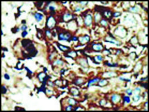 Anti-PACSIN2 (C-term) antibody produced in rabbit IgG fraction of antiserum, buffered aqueous solution