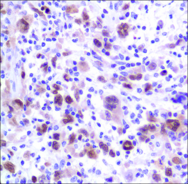 Anti-MUM1/IRF4 antibody, Rabbit monoclonal recombinant, expressed in proprietary host, clone SP114, affinity isolated antibody