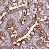 Anti-DUSP28 antibody produced in rabbit Prestige Antibodies® Powered by Atlas Antibodies, affinity isolated antibody, buffered aqueous glycerol solution