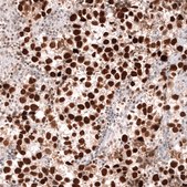 Monoclonal Anti-Msh2 Antibody Produced In Mouse Prestige Antibodies® Powered by Atlas Antibodies, clone CL13713, affinity isolated antibody, buffered aqueous glycerol solution