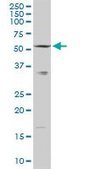 Anti-SLC33A1 antibody produced in rabbit purified immunoglobulin, buffered aqueous solution