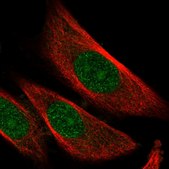 Anti-SKP2 antibody produced in rabbit Prestige Antibodies® Powered by Atlas Antibodies, affinity isolated antibody