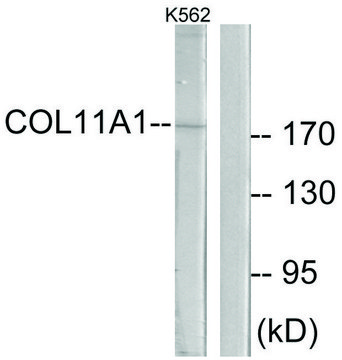 Anti-Collagen XI &#945;1 antibody produced in rabbit affinity isolated antibody