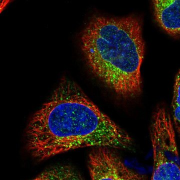 Anti-TMC7 antibody produced in rabbit Prestige Antibodies&#174; Powered by Atlas Antibodies, affinity isolated antibody, buffered aqueous glycerol solution