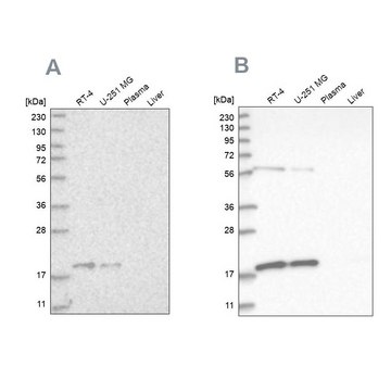 Anti-MRPS10 antibody produced in rabbit Prestige Antibodies&#174; Powered by Atlas Antibodies, affinity isolated antibody, buffered aqueous glycerol solution, ab1