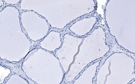 Anti-Bcl-2 Antibody, clone 1K8 ZooMAb® Rabbit Monoclonal recombinant, expressed in HEK 293 cells