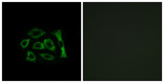 Anti-ERD22 antibody produced in rabbit affinity isolated antibody