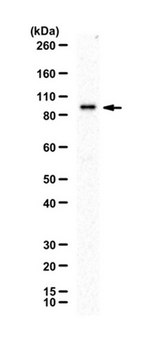 Anti-Glucocorticoid Receptor Antibody serum, from rabbit