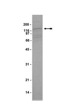 Arg Protein, active, 10 &#181;g Active, N-terminal His6-tagged, recombinant amino acids, 27-end, mouse Arg, for use in Kinase Assays.