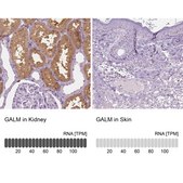 Anti-GALM antibody produced in rabbit Prestige Antibodies® Powered by Atlas Antibodies, affinity isolated antibody, buffered aqueous glycerol solution