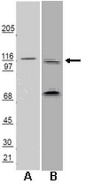 Anti-Huntingtin-Interacting Protein 1 Related (HIP1R) Antibody Chemicon&#174;, from rabbit