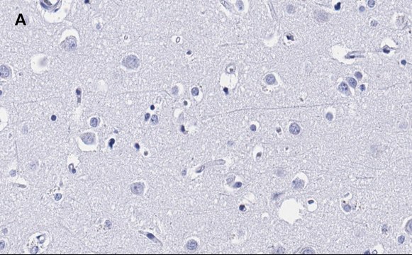 Anti-MBP Antibody, clone 2N6 , ZooMAb&#174; Rabbit Monoclonal recombinant, expressed in HEK 293 cells