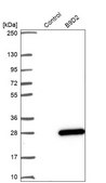 Anti-B9D2 antibody produced in rabbit Prestige Antibodies® Powered by Atlas Antibodies, affinity isolated antibody, buffered aqueous glycerol solution