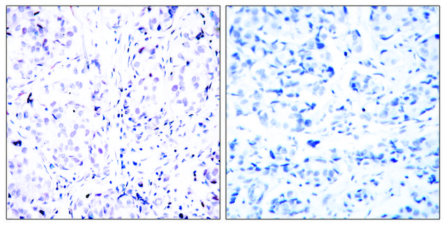 Anti-Retinoblastoma, C-Terminal antibody produced in rabbit affinity isolated antibody