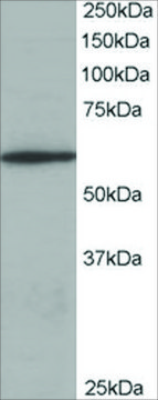 Anti-Coronin 1/TACO antibody produced in goat affinity isolated antibody, buffered aqueous solution