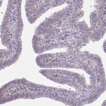 Anti-MUS81 antibody produced in rabbit Prestige Antibodies&#174; Powered by Atlas Antibodies, affinity isolated antibody, buffered aqueous glycerol solution