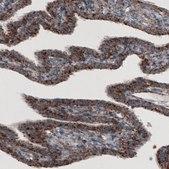 Monoclonal Anti-LAMP1 antibody produced in mouse Prestige Antibodies® Powered by Atlas Antibodies, clone CL3484, purified immunoglobulin, buffered aqueous glycerol solution