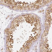 Monoclonal Anti-RHOT1 antibody produced in mouse Prestige Antibodies® Powered by Atlas Antibodies, clone CL1095, purified immunoglobulin, buffered aqueous glycerol solution