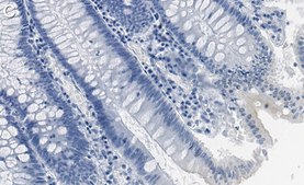 Anti-p-DNA-PKcs-Ser2056 Antibody, clone 1K3 ZooMAb® Rabbit Monoclonal recombinant, expressed in HEK 293 cells