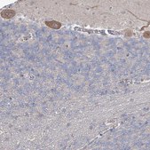 Anti-SH3BP5L antibody produced in rabbit Prestige Antibodies® Powered by Atlas Antibodies, affinity isolated antibody, buffered aqueous glycerol solution