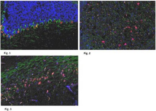 Anti-CELSR1 Antibody from rabbit, purified by affinity chromatography