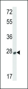 ANTI-SOST (CENTER) antibody produced in rabbit IgG fraction of antiserum, buffered aqueous solution