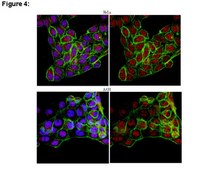 ChIPAb+ JMJD6 - ChIP Validated Antibody and Primer Set from rabbit, purified by affinity chromatography