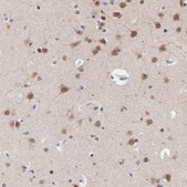 Anti-CHM antibody produced in rabbit Prestige Antibodies® Powered by Atlas Antibodies, affinity isolated antibody, buffered aqueous glycerol solution